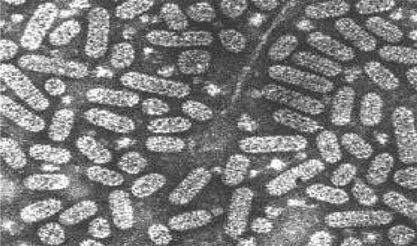 عامل بیماری ویروس موزائیك یونجه